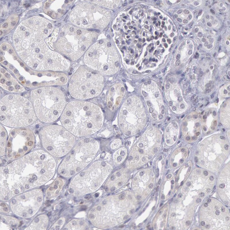COX-2 Antibody - BSA Free Immunohistochemistry-Paraffin: COX-2 Antibody [NBP1-85499]