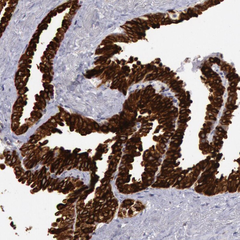 COX-2 Antibody - BSA Free Immunohistochemistry-Paraffin: COX-2 Antibody [NBP1-85499]