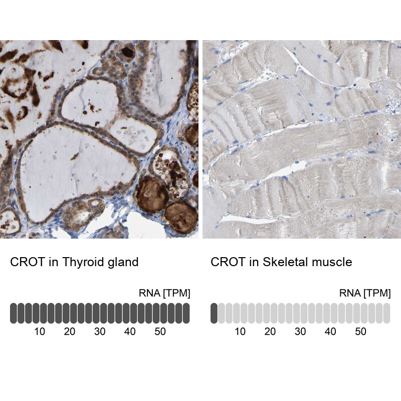 CROT Antibody - BSA Free Immunohistochemistry-Paraffin: CROT Antibody [NBP1-85502]