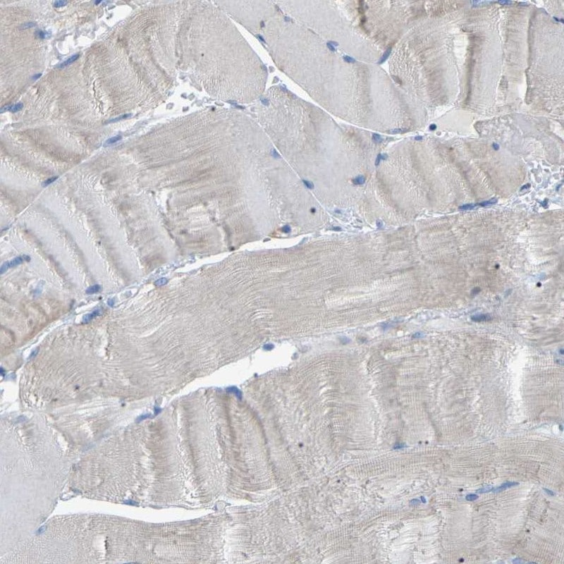 CROT Antibody - BSA Free Immunohistochemistry-Paraffin: CROT Antibody [NBP1-85502]