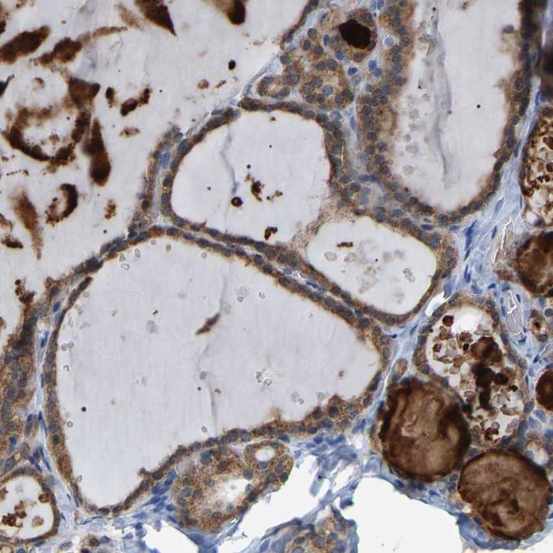 CROT Antibody - BSA Free Immunohistochemistry-Paraffin: CROT Antibody [NBP1-85502]