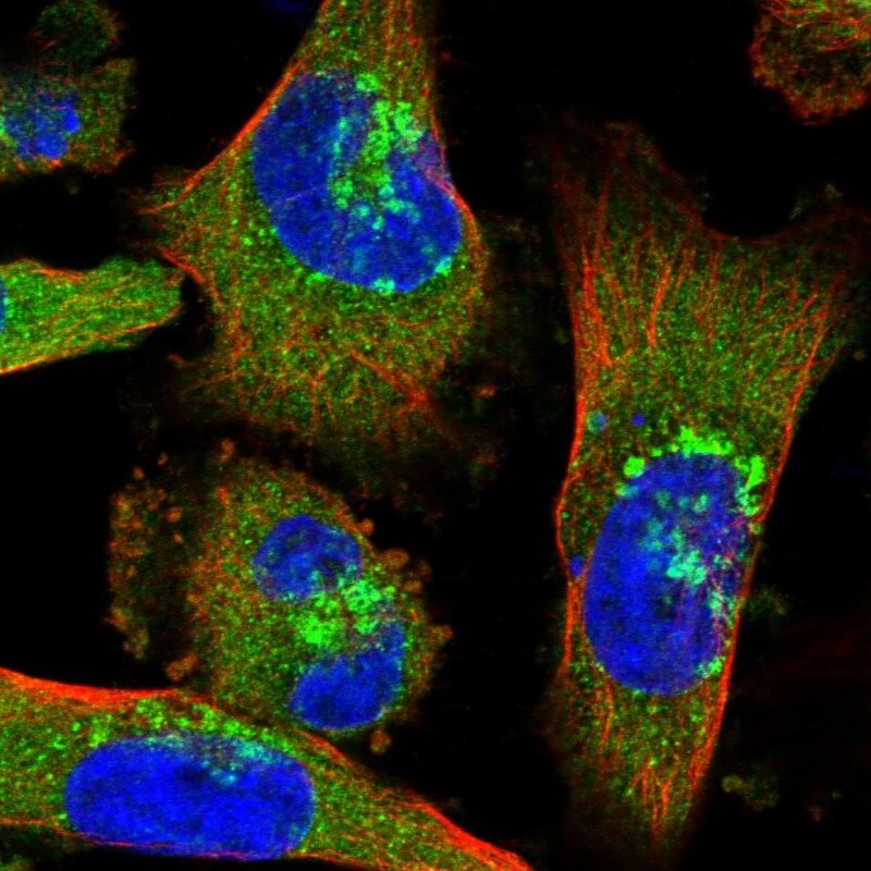 Coatomer Subunit Delta Antibody - BSA Free Immunocytochemistry/ Immunofluorescence: Coatomer Subunit Delta Antibody [NBP1-85515]
