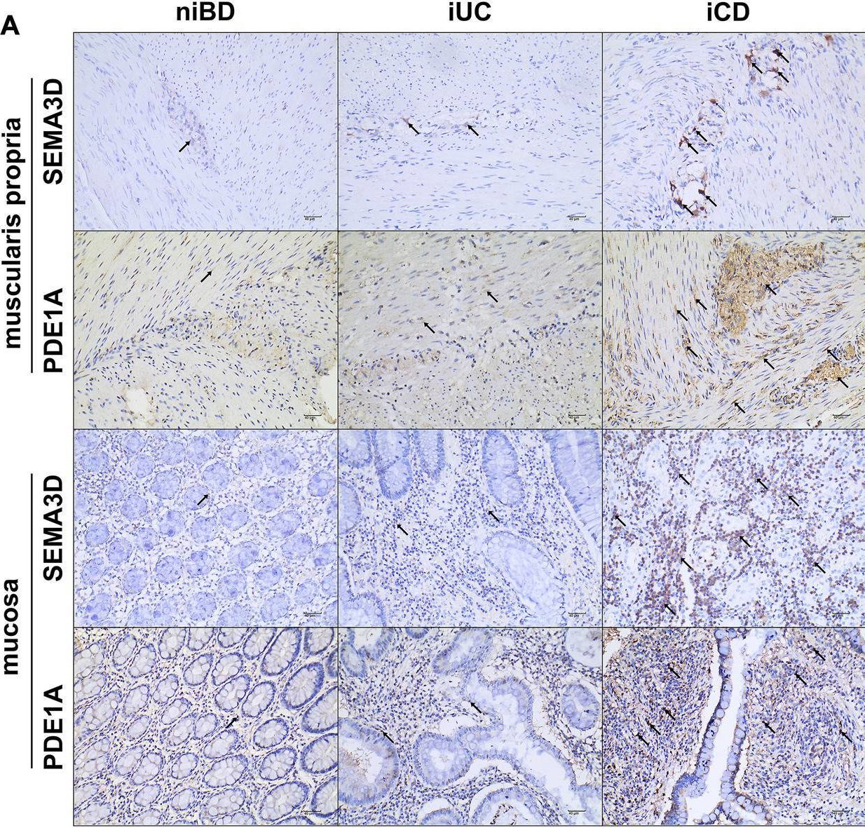 SEMA3D Antibody - BSA Free