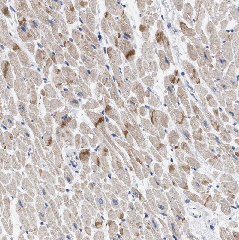 XIRP1 Antibody - BSA Free Immunohistochemistry-Paraffin: XIRP1 Antibody [NBP1-85530]
