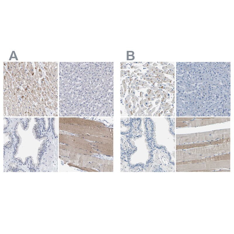 XIRP1 Antibody - BSA Free Immunohistochemistry-Paraffin: XIRP1 Antibody [NBP1-85530]