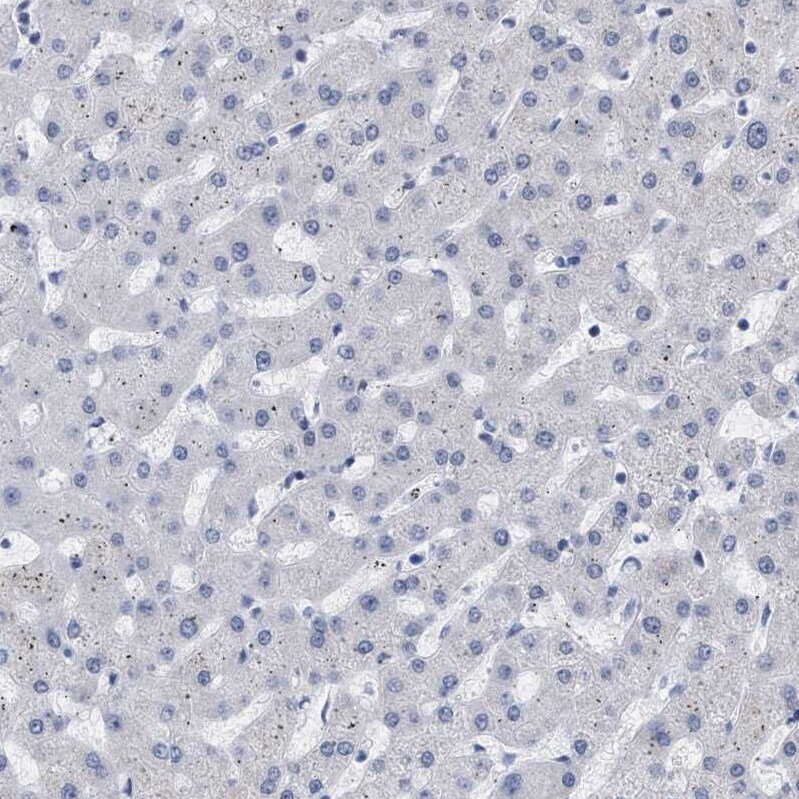 XIRP1 Antibody - BSA Free Immunohistochemistry-Paraffin: XIRP1 Antibody [NBP1-85530]