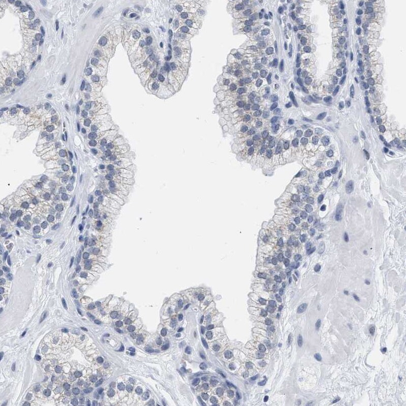 XIRP1 Antibody - BSA Free Immunohistochemistry-Paraffin: XIRP1 Antibody [NBP1-85530]