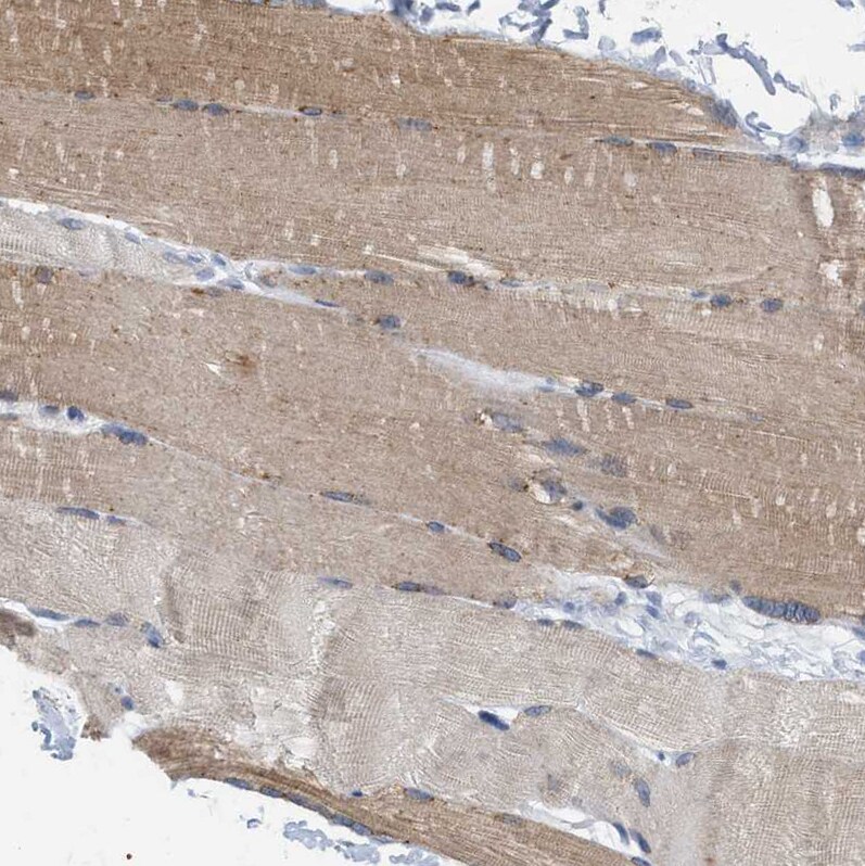 XIRP1 Antibody - BSA Free Immunohistochemistry-Paraffin: XIRP1 Antibody [NBP1-85530]