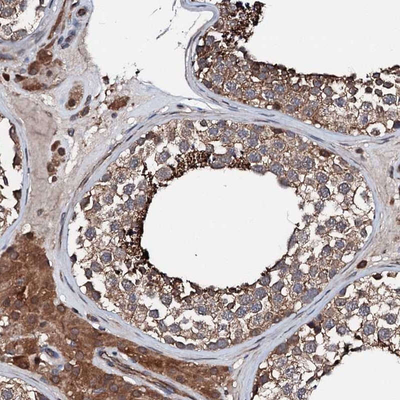 FGD4 Antibody - BSA Free Immunohistochemistry-Paraffin: FGD4 Antibody [NBP1-85532]