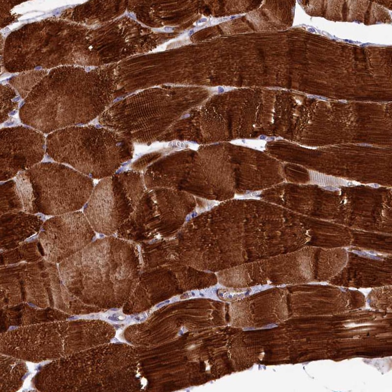 Rapsyn Antibody - BSA Free Immunohistochemistry-Paraffin: Rapsyn Antibody [NBP1-85537]