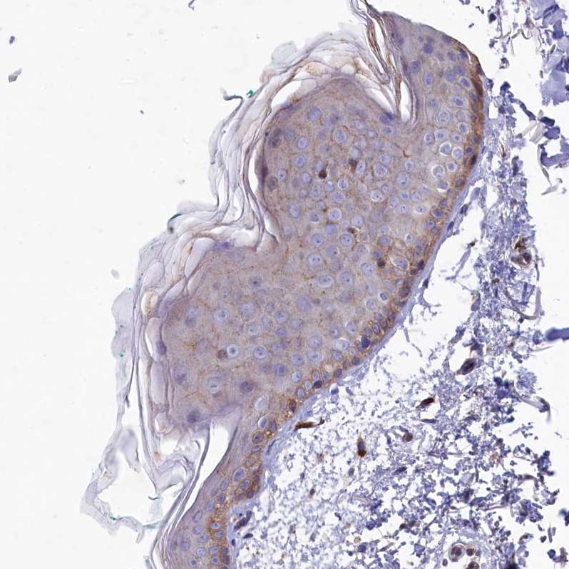 Rapsyn Antibody - BSA Free Immunohistochemistry-Paraffin: Rapsyn Antibody [NBP1-85537]