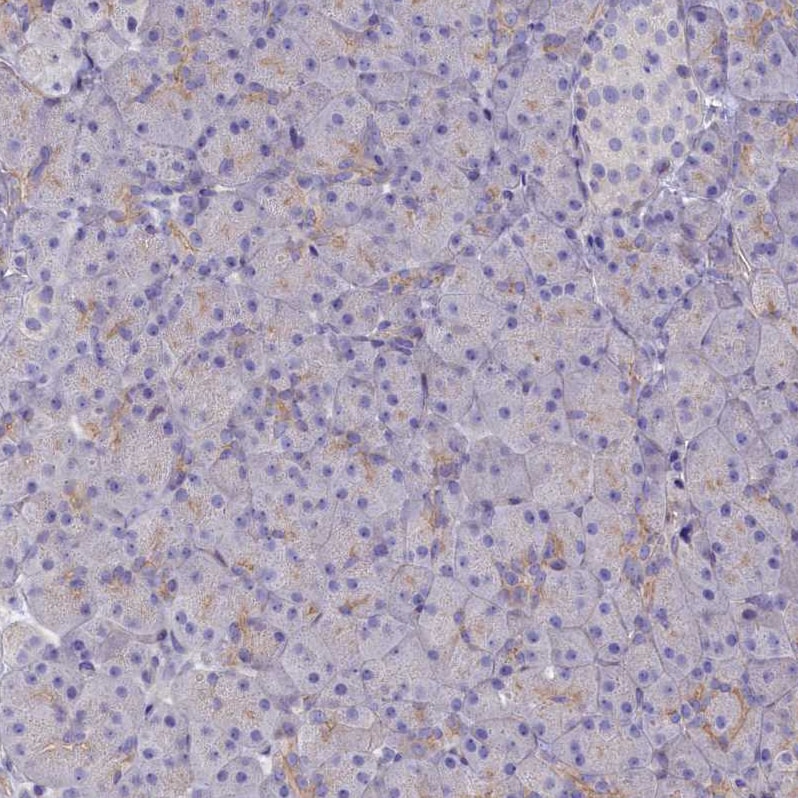 Rapsyn Antibody - BSA Free Immunohistochemistry-Paraffin: Rapsyn Antibody [NBP1-85537]