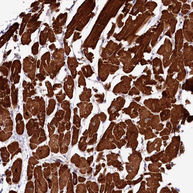 Rapsyn Antibody - BSA Free Immunohistochemistry-Paraffin: Rapsyn Antibody [NBP1-85537]