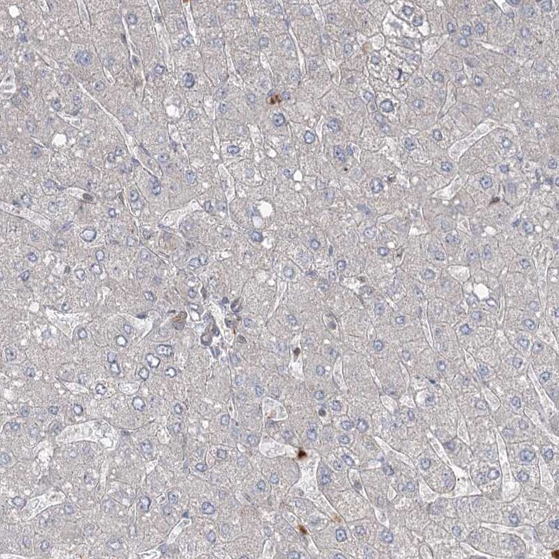 ZNF711 Antibody - BSA Free Immunohistochemistry-Paraffin: ZNF711 Antibody [NBP1-85538]