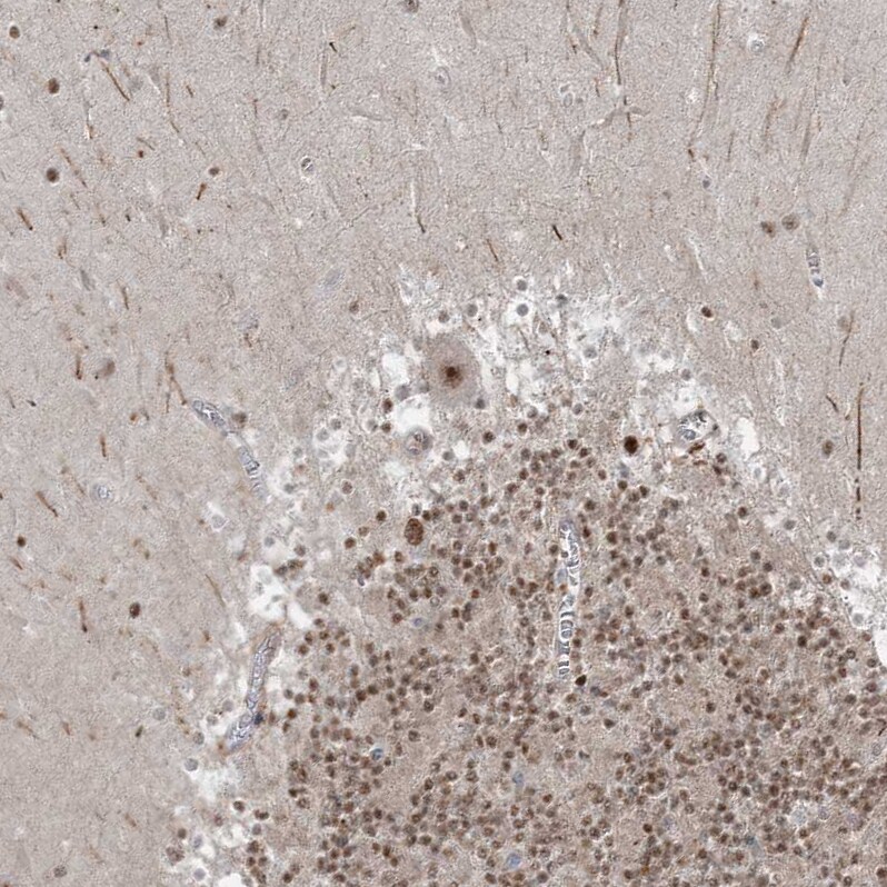 ZNF711 Antibody - BSA Free Immunohistochemistry-Paraffin: ZNF711 Antibody [NBP1-85538]