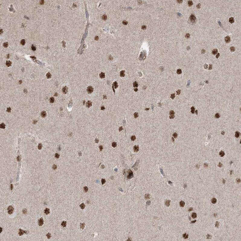 ZNF711 Antibody - BSA Free Immunohistochemistry-Paraffin: ZNF711 Antibody [NBP1-85538]