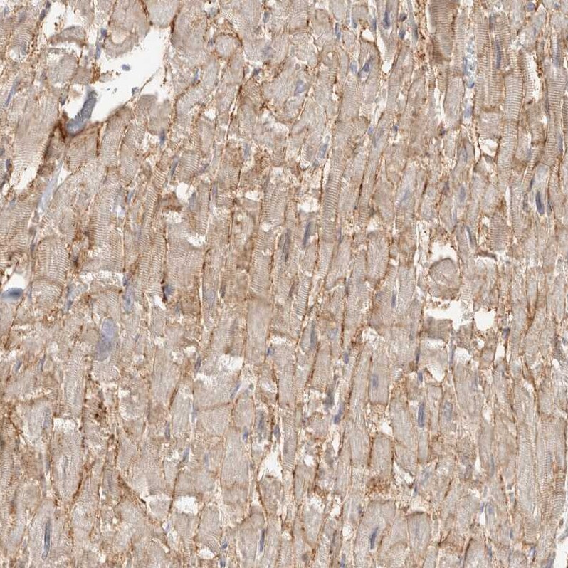 delta-Sarcoglycan Antibody - BSA Free Immunohistochemistry: delta-Sarcoglycan Antibody - BSA Free [NBP1-85545]