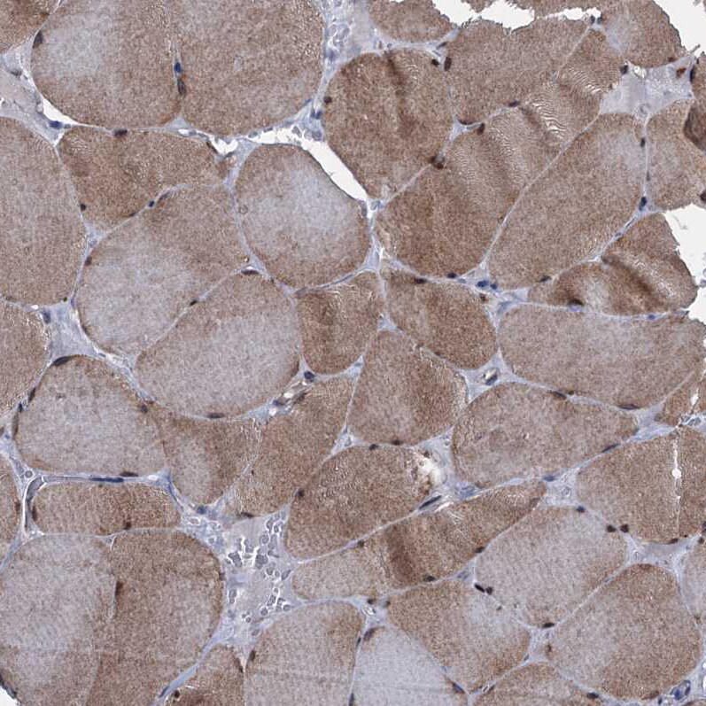 EYA4 Antibody - BSA Free Immunohistochemistry-Paraffin: EYA4 Antibody [NBP1-85546]