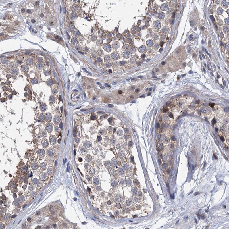 EYA4 Antibody - BSA Free Immunohistochemistry-Paraffin: EYA4 Antibody [NBP1-85546]