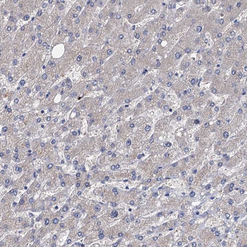 EYA4 Antibody - BSA Free Immunohistochemistry-Paraffin: EYA4 Antibody [NBP1-85546]