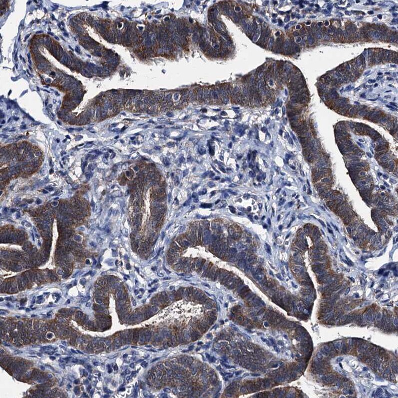 EYA4 Antibody - BSA Free Immunohistochemistry-Paraffin: EYA4 Antibody [NBP1-85546]