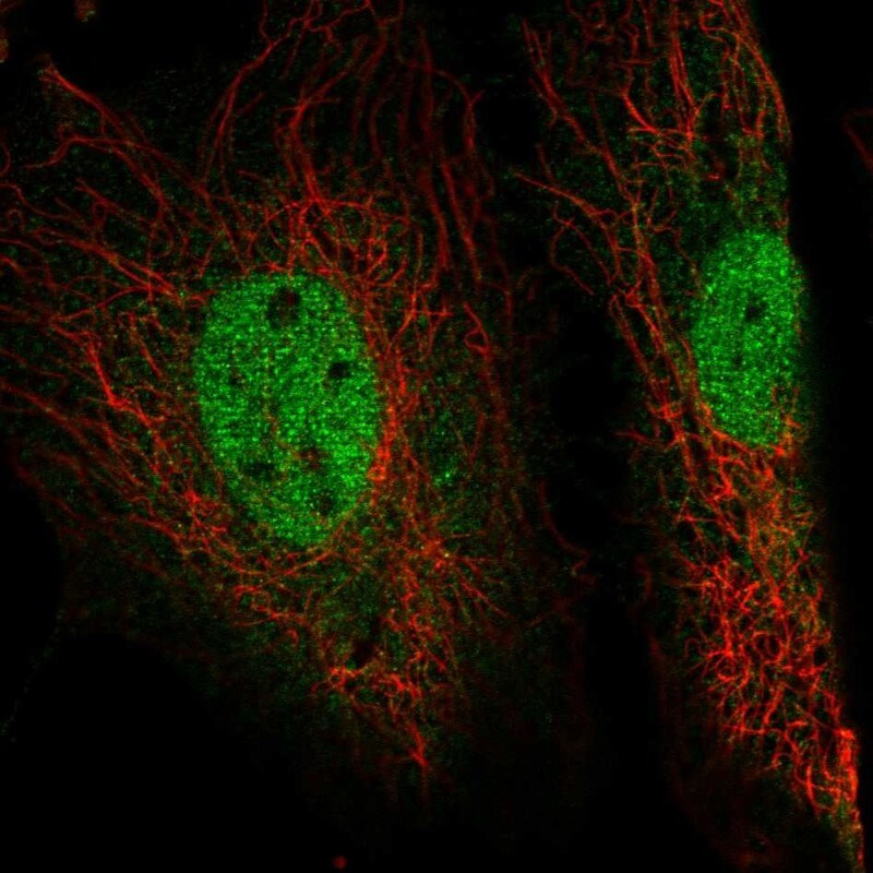 EYA4 Antibody - BSA Free Immunocytochemistry/ Immunofluorescence: EYA4 Antibody [NBP1-85548]