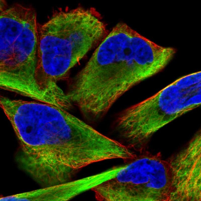 Desmin Antibody - BSA Free Immunocytochemistry/ Immunofluorescence: Desmin Antibody [NBP1-85549]