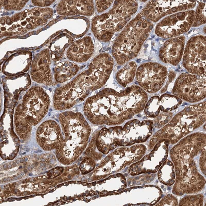 NLRP10/Pynod/NALP10 Antibody - BSA Free Immunohistochemistry: NLRP10/Pynod/NALP10 Antibody - BSA Free [NBP1-85556]