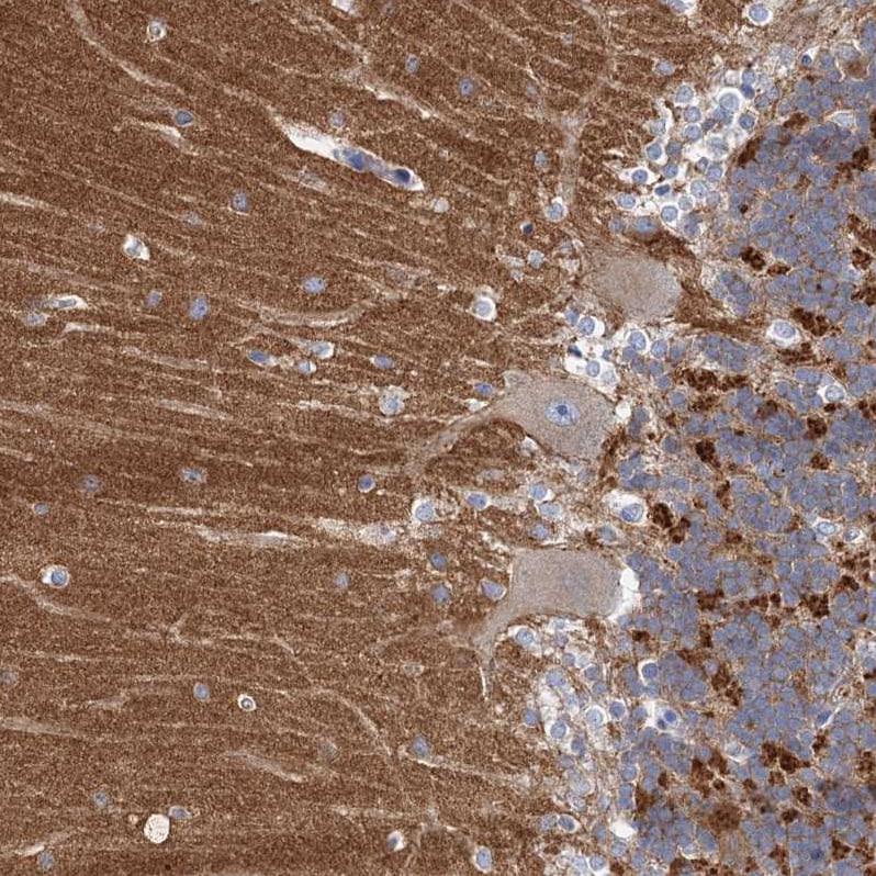 NLRP10/Pynod/NALP10 Antibody - BSA Free Immunohistochemistry-Paraffin: NLRP10/Pynod/NALP10 Antibody [NBP1-85557]