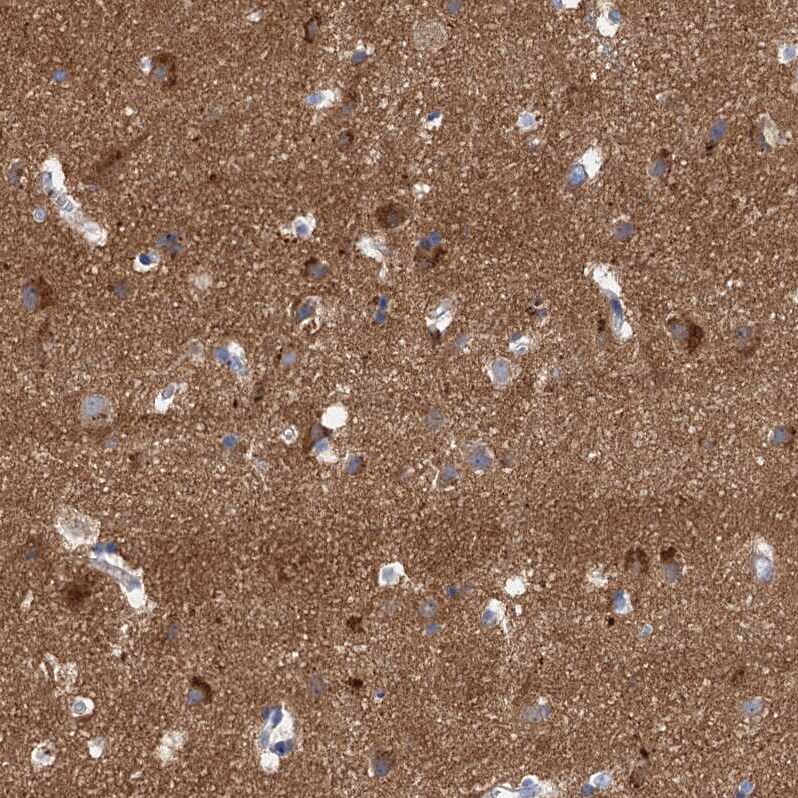 NLRP10/Pynod/NALP10 Antibody - BSA Free Immunohistochemistry-Paraffin: NLRP10/Pynod/NALP10 Antibody [NBP1-85557]