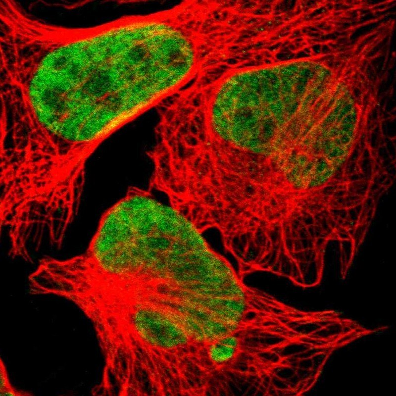 Hexim 1 Antibody - BSA Free Immunocytochemistry/ Immunofluorescence: Hexim 1 Antibody [NBP1-85559]