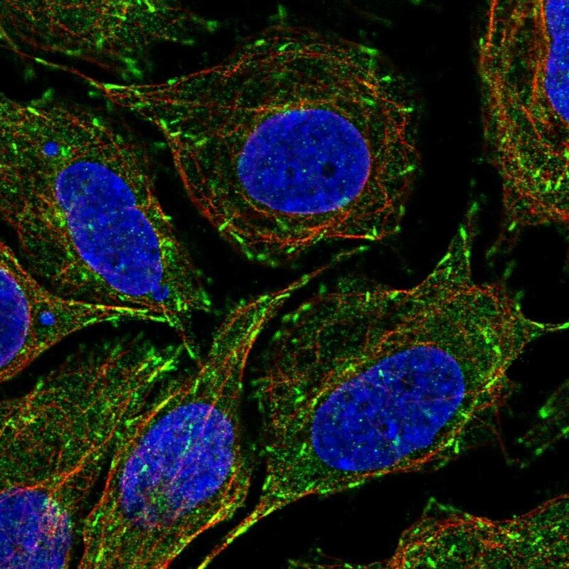 CLIP170 Antibody - BSA Free Immunocytochemistry/ Immunofluorescence: CLIP170 Antibody [NBP1-85568]