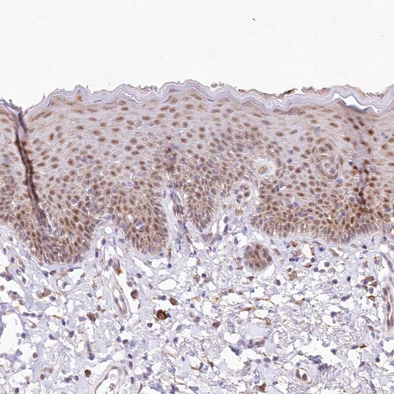 LDB1 Antibody - BSA Free Immunohistochemistry-Paraffin: LDB1 Antibody [NBP1-85573]