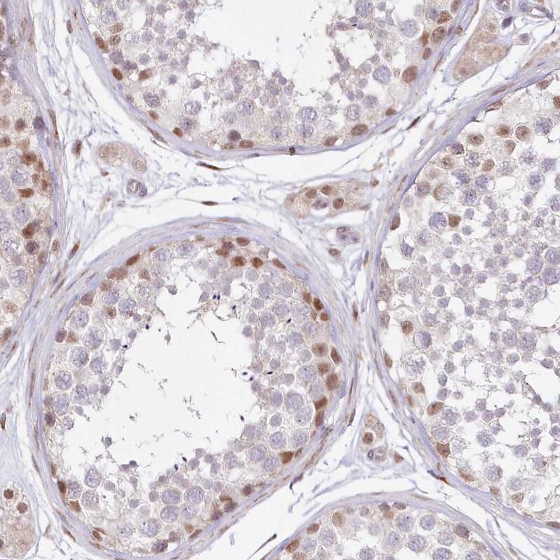LDB1 Antibody - BSA Free Immunohistochemistry-Paraffin: LDB1 Antibody [NBP1-85573]