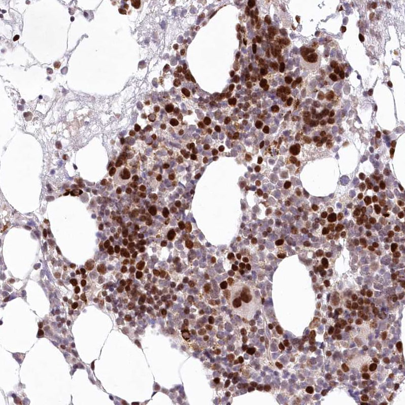 LDB1 Antibody - BSA Free Immunohistochemistry-Paraffin: LDB1 Antibody [NBP1-85573]