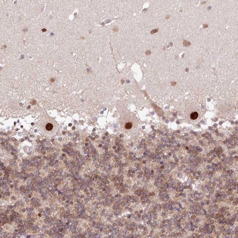 LDB1 Antibody - BSA Free Immunohistochemistry-Paraffin: LDB1 Antibody [NBP1-85573]