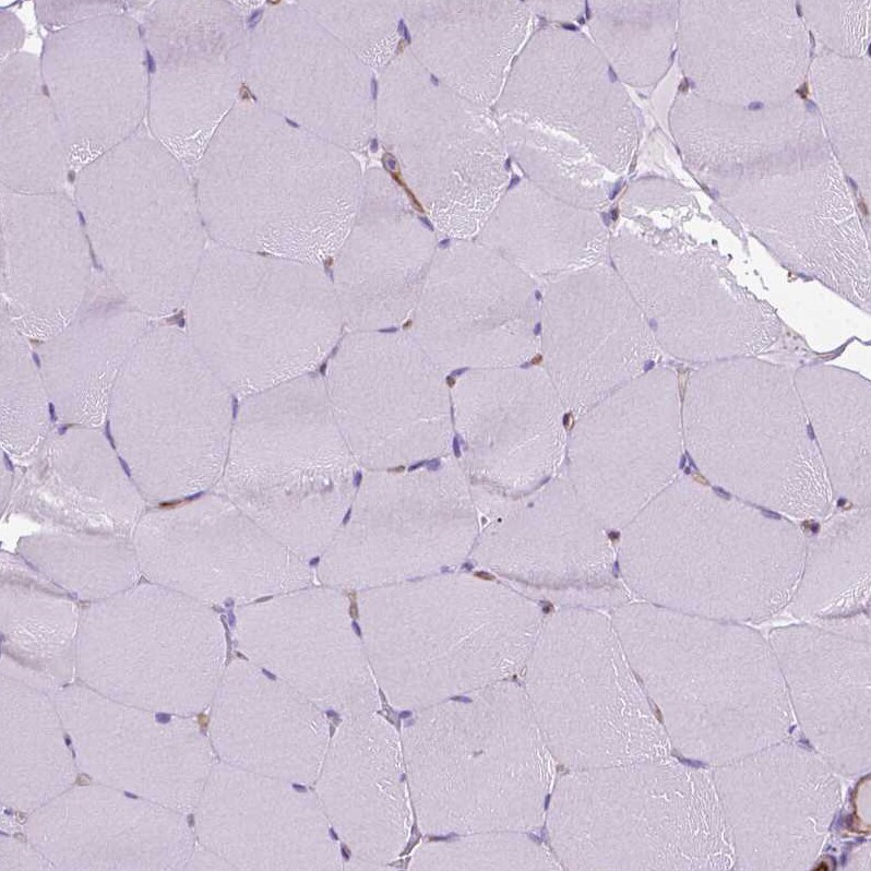 CLIC4 Antibody - BSA Free Immunohistochemistry-Paraffin: CLIC4 Antibody - BSA Free [NBP1-85574]