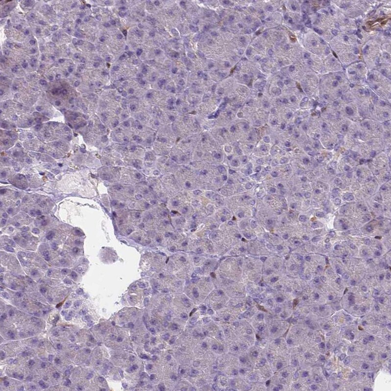 CLIC4 Antibody - BSA Free Immunohistochemistry-Paraffin: CLIC4 Antibody - BSA Free [NBP1-85574]