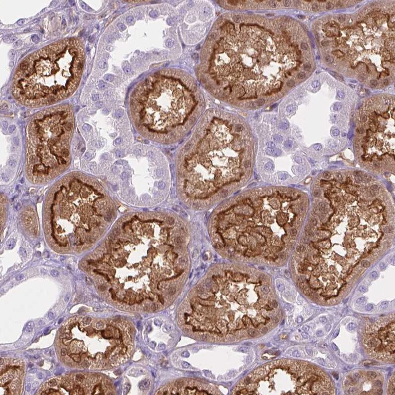 CLIC4 Antibody - BSA Free Immunohistochemistry-Paraffin: CLIC4 Antibody - BSA Free [NBP1-85574]