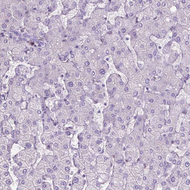 CLIC4 Antibody - BSA Free Immunohistochemistry-Paraffin: CLIC4 Antibody - BSA Free [NBP1-85574]