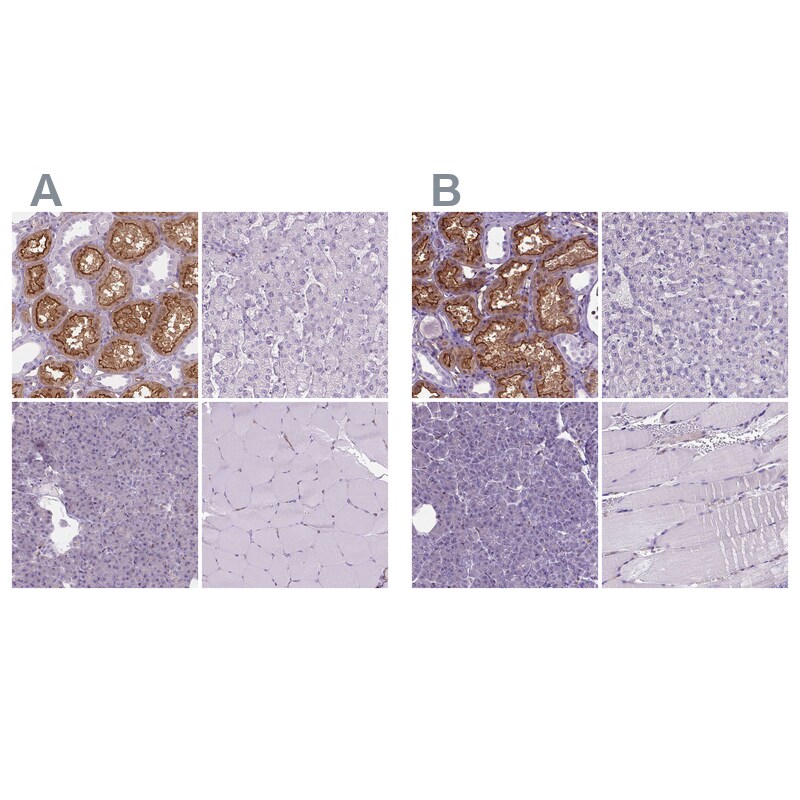 CLIC4 Antibody - BSA Free Immunohistochemistry-Paraffin: CLIC4 Antibody - BSA Free [NBP1-85574]