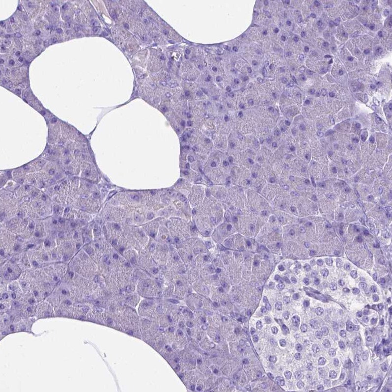 MMP-9 Antibody - BSA Free Immunohistochemistry-Paraffin: MMP-9 Antibody - BSA Free [NBP1-85575]