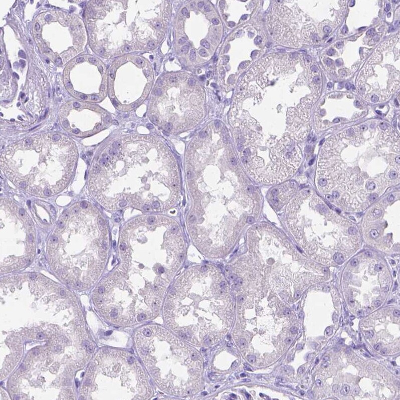 MMP-9 Antibody - BSA Free Immunohistochemistry-Paraffin: MMP-9 Antibody - BSA Free [NBP1-85575]
