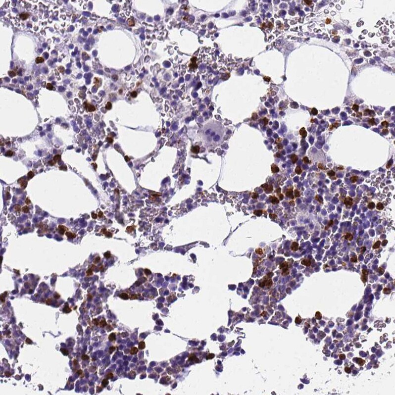 MMP-9 Antibody - BSA Free Immunohistochemistry-Paraffin: MMP-9 Antibody - BSA Free [NBP1-85575]