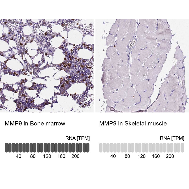 MMP-9 Antibody - BSA Free Immunohistochemistry-Paraffin: MMP-9 Antibody - BSA Free [NBP1-85575]