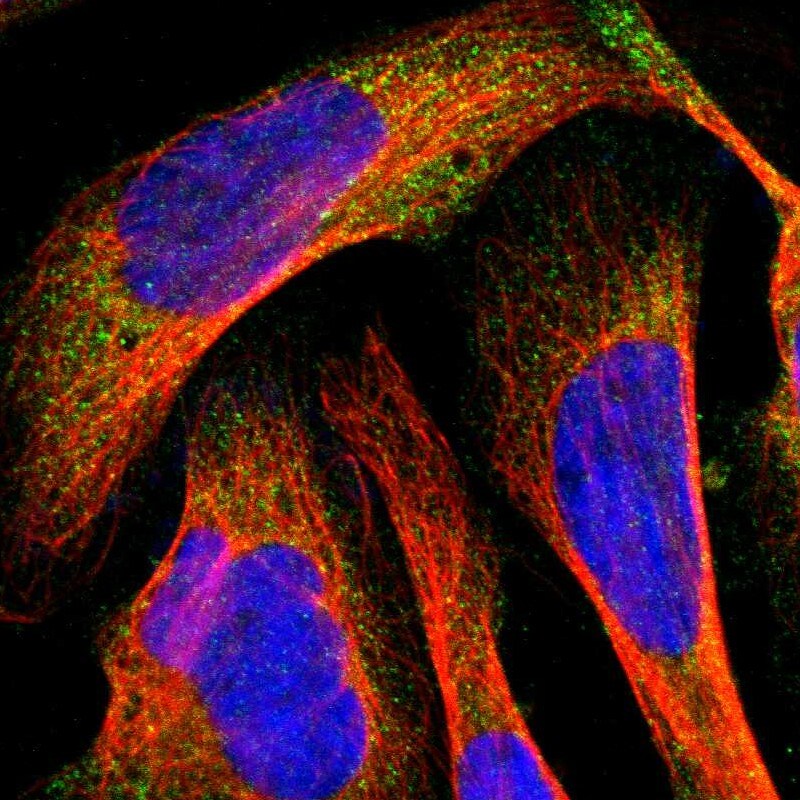 MMP-9 Antibody - BSA Free Immunocytochemistry/ Immunofluorescence: MMP-9 Antibody - BSA Free [NBP1-85575]