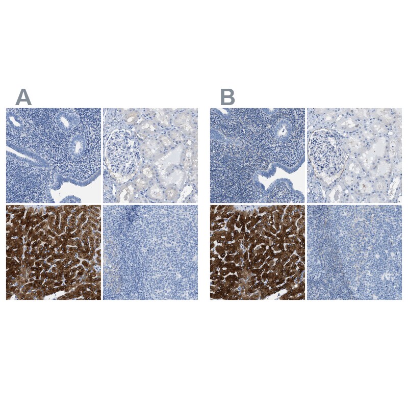 ASGPR1 Antibody Immunohistochemistry-Paraffin: ASGPR1 Antibody Antibody [NBP1-85580]