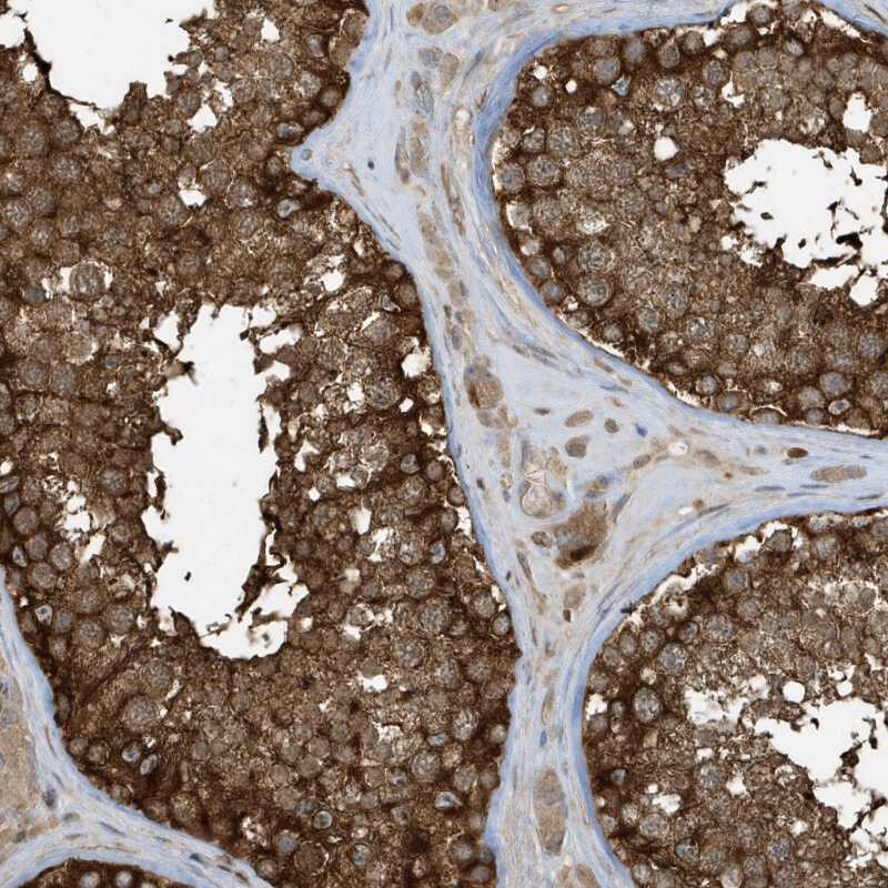 CLCN6 Antibody - BSA Free Immunohistochemistry: CLCN6 Antibody - BSA Free [NBP1-85583]