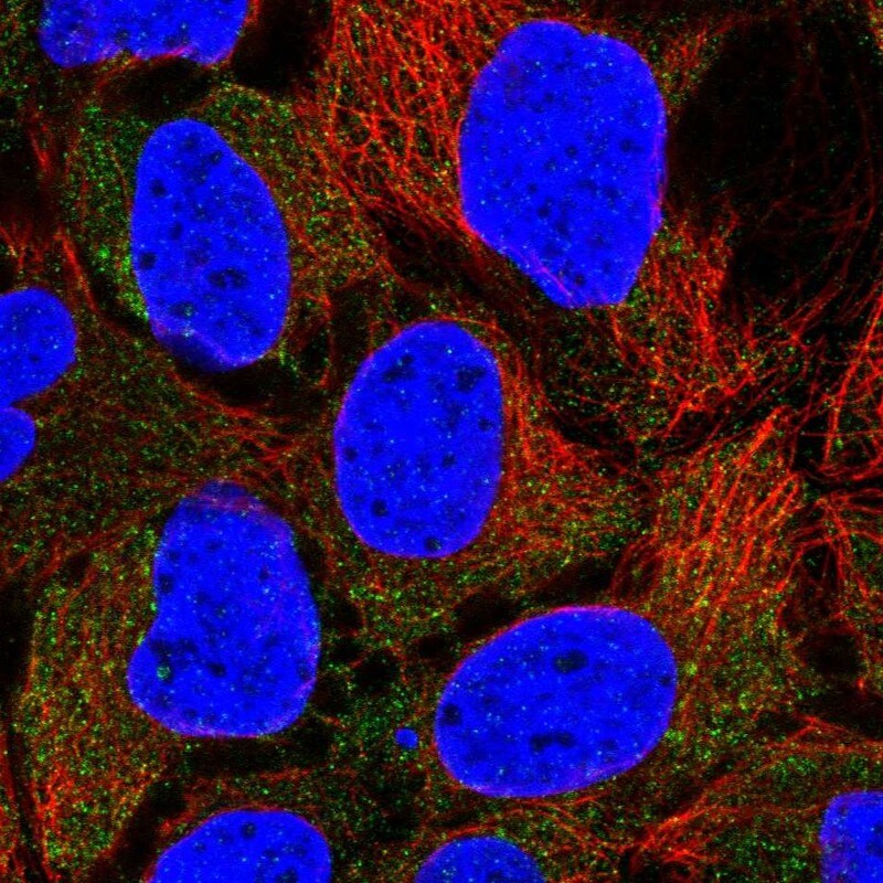 CLCN2 Antibody - BSA Free Immunocytochemistry/ Immunofluorescence: CLCN2 Antibody [NBP1-85585]