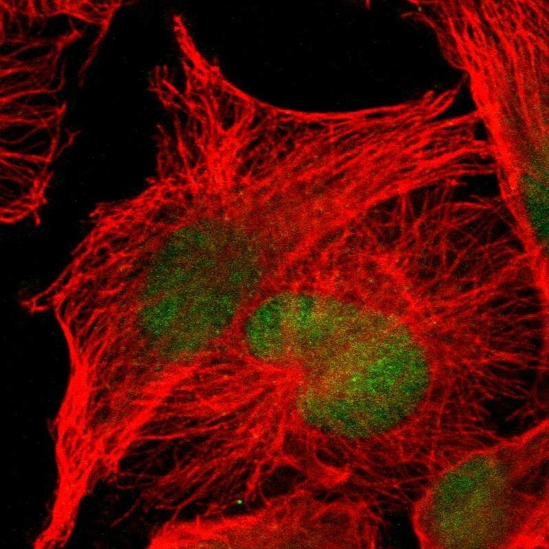 CAMKID Antibody - BSA Free Immunocytochemistry/ Immunofluorescence: CAMKID Antibody - BSA Free [NBP1-85589]